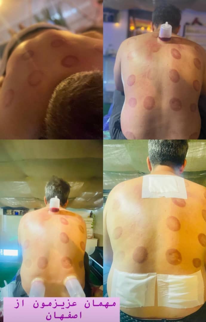 سالن ماساژ رامان در بابلسر